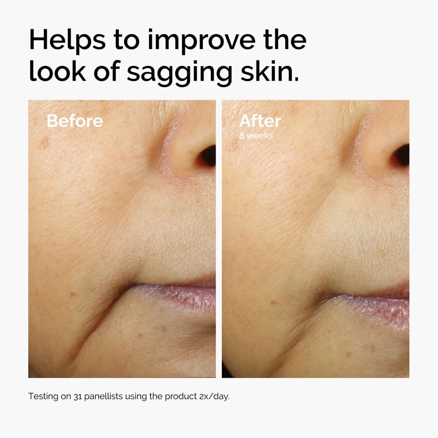 caffeine-3-escin-1-face-serum-f9 ord-caffeine-3pct-escin-1pct-face-serum-before-after-sagging.jpg