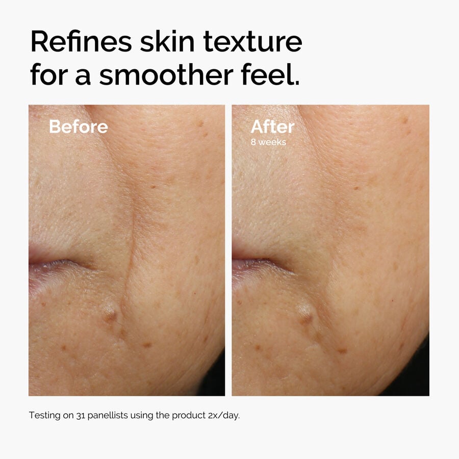 caffeine-3-escin-1-face-serum-f9 ord-caffeine-3pct-escin-1pct-face-serum-before-after-texture.jpg