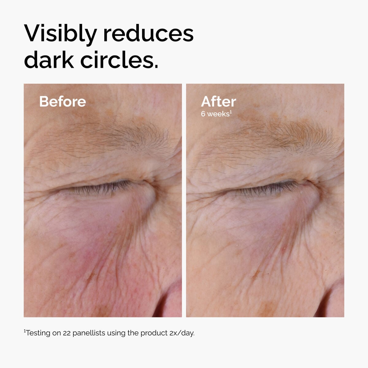 caffeine-solution-5-egcg-eye-serum-k3 ord-caffeine-solution-egcg-dark-circles-before-after.jpg