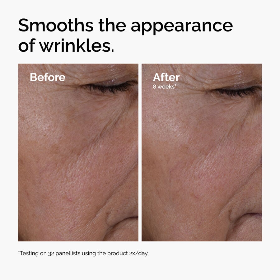 multi-peptide-ha-serum-k9 ord-multi-peptide-ha-serum-wrinkles-before-after.jpg