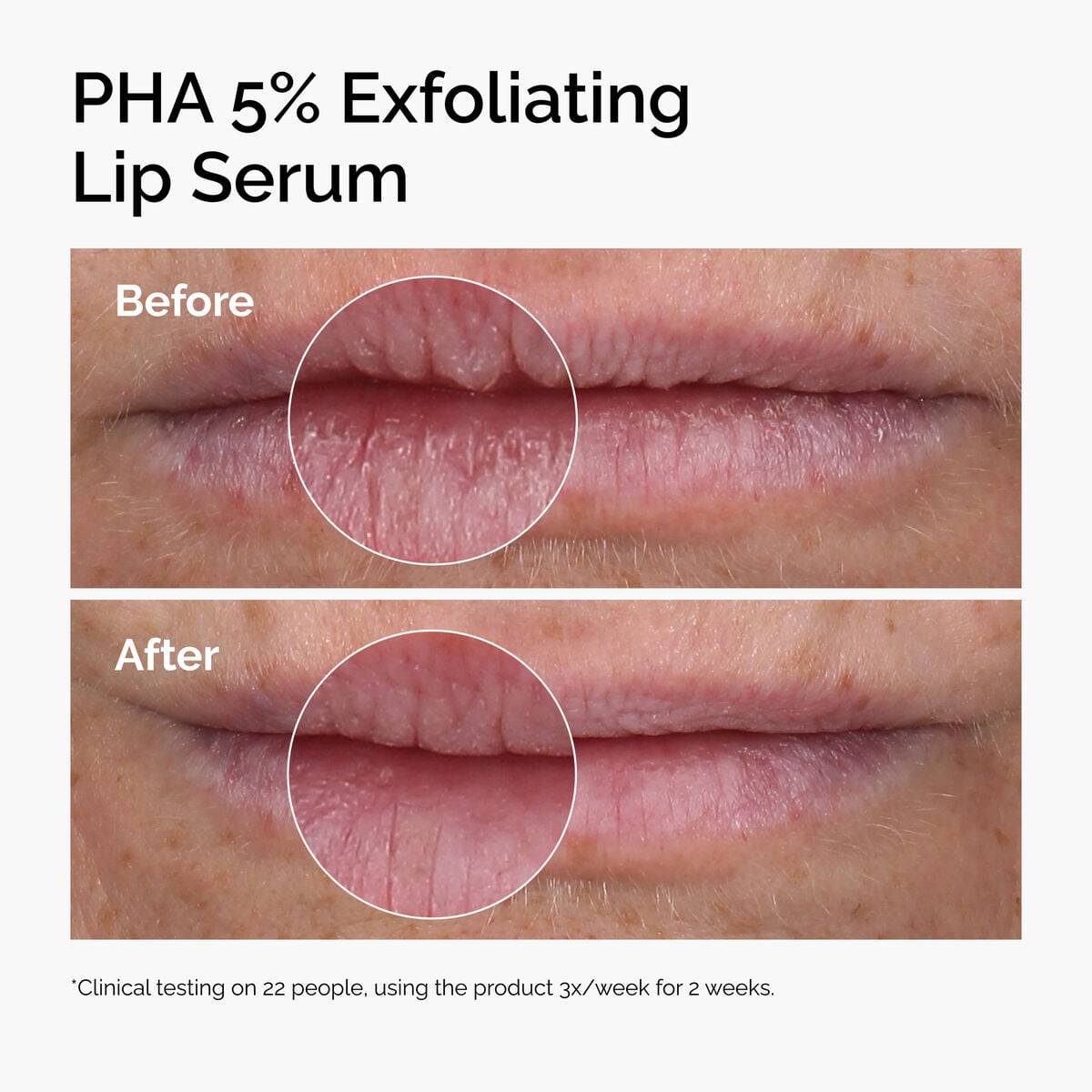 pha-5-exfoliating-lip-serum-d1 ord-pha-5pct-lip-exfoliating-serum-before-after.jpg