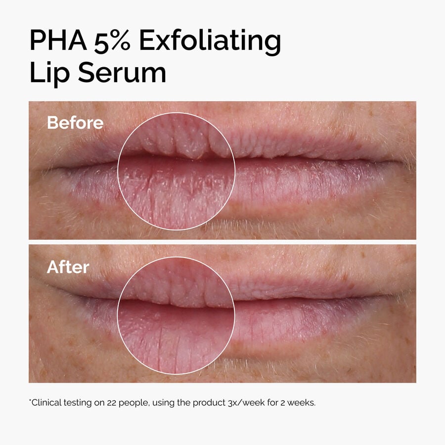 pha-5-exfoliating-lip-serum-d1 ord-pha-5pct-lip-exfoliating-serum-before-after.jpg